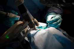 World's first robotic-assisted eye surgery